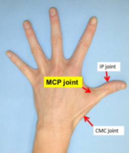 Image result for MP thumb joint