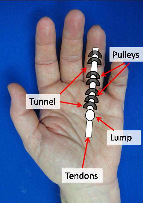 Handout_TrigThumb_03.jpg - 40.55 kB