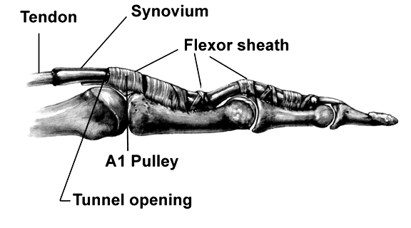 Handout_TrigThumb_04JPG.jpg - 53.53 kB